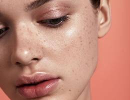 How To Tackle Sensitive Skin According To The Pros