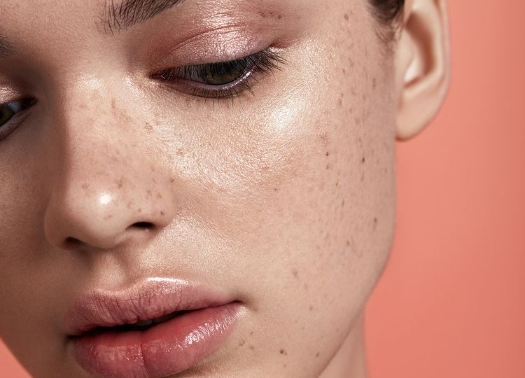 How To Tackle Sensitive Skin According To The Pros